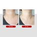 MediPeel Firming Neck Cream with Collagen & Retinol | Anti-Aging Neck Wrinkle Repair | Skin Tightening & Double Chin Reducer | Korean Skincare - 3.3 fl oz - Buy Online on GoSupps.com