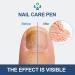 Lot de 2 stylos de r paration pour ongles - Pour ongles et orteils soign s - Protection et renforcement des ongles cassants - Am liore l'apparence des ongles endommag s par les ongles bleu 1 pi ce - Buy Online on GoSupps.com