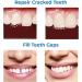 Temporary Tooth Filling Repair Kit - Dental Tooth Filler for Missing or Broken Teeth - Buy Online on GoSupps.com