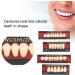 Temporary Tooth Repair Set - Synthetic Resin Filling for Lost Teeth | Dental Care Tools for International Shipping - Buy Online on GoSupps.com