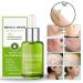 flysmus Advanced Scar Repair Serum - Medical Grade Spray for All Types of Scars (1PCS) - Buy Online on GoSupps.com