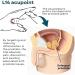 Prostate Care Point Clip | Acupressure Relief for Discomfort & Migraine - Effortless Pressure Point Solution for Men - Buy Online on GoSupps.com