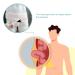 Hernia Belt Gear - Inguinal Groin Support Brace with Air Bag | Compression Guard for Groin Pain Relief (Size L: 102 5cm) - Worldwide Shipping - Buy Online on GoSupps.com