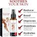 Kolmax Vitiligo & Psoriasis Relief Spray - Reduces White Spots on Skin (1 Pcs) - Buy Online on GoSupps.com