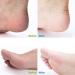 Foot File Callus Remover Surgical Steel Dual-Sided Foot Rasp Pedicure for Feet Care Hard Skin Remove - Buy Online on GoSupps.com