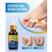 30ML Fungal nail repair fluid MYMULIKE toenail fungus repair extra strong nail repair solution for toenails and fingernails protects thick broken and discolored nails with - Buy Online on GoSupps.com