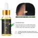 Anti Hair Loss Products Organic Hair Regrowth Kit Ginger Oil Hair Regrowth Serum with Activation Roller Promotes Thickening Repairs Hair Follicles - Buy Online on GoSupps.com