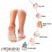 Pedimend Metatarsal Gel Cushion - 2 Count Pack for Ball of Foot Pain Relief and Neuroma Support - Buy Online on GoSupps.com