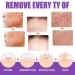 Skin Tag Removal Solution.(2PC 30ML) 2PC 30ml - Buy Online on GoSupps.com