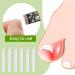 Jocaluyia Ingrown Toenail Corrector Strips 50Pcs Straightener Strip Curved Toenails Correction Patches Nail Support Spacer Tube Professional Pedicure Tools for Men Women Foot Care - Buy Online on GoSupps.com