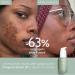 Caudalie Vinopure Natural Salicylic Acid Pore Minimizing Serum - 30mL - Buy Online on GoSupps.com