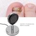 Light Onychomycosis Treatment Device - Effective Onychomycosis Remover - Buy Online on GoSupps.com