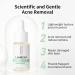LANBENA 10% Salicylic Acid Serum - Acne Repair & Soothing Formula for Sensitive Skin | International Shipping - Buy Online on GoSupps.com