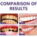 Teeth Repairing Foam & Whitening Mouthwash - Eliminate Bad Breath & Prevent Cavities (2 Pack) - Buy Online on GoSupps.com