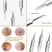 Usiveinborn Blackhead Remover Usiveinborn Usiveinborn Tweezers Professional Facial Blackhead Remover Tweezers Stainless Steel Usiveinborn Blackhead Tweezers (Angled Clip) - Buy Online on GoSupps.com