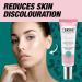 SkinLabo Intensive Anti-Stain Cream with High Effectiveness Makes the Skin Brighter and More Uniform with Brightenil and Niacinamide - 30 ml (Old Version) - Buy Online on GoSupps.com
