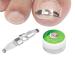 Ingrown Toenail Treatment Kit for Pain Relief - Paronychia Corrector Tool Set for Salon and Home Use - Buy Online on GoSupps.com