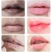  JIAOY JINSHANE Lip Serum Jinshane Lip Jinshane Lip Lightening Treatment Jinshane Treatment for Dark Lips Lip Fresh Treatment to Remove Dark Lips Moisturizing Lip Balm - Buy Online on GoSupps.com