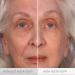 Serious Skincare INSTA-TOX Facial Firming Serum & Reverse Lift Eye Cream Bundle - Buy Online on GoSupps.com