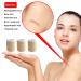 IGOOLEE Silicone Scar Sheets Strips Tape - 3 Reusable Rolls for Surgical Scar Removal - 1.57 x 120 Size - Ideal for Keloid & C-Section Scars - Buy Online on GoSupps.com