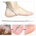 Stainless Steel Horn Skin Remover - Pedicure Tool with 10 Replacement Blades for Wet & Dry Feet | Effective Hard Skin Corneal Care - Buy Online on GoSupps.com