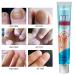 Best Nail Repair Cream for Fungus Treatment - Restores Discolored Nails - Toe & Finger Care - Buy Online on GoSupps.com