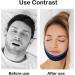 4 Pcs Anti Snoring Devices Snoring Aids for Men Chin Strap Mouth Breathing Snoring Chin Strap Anti Snoring Anti Snore Devices Anti Snoring Chin Strap Sleep Apnea Devices for Men Women(Black Blue) - Buy Online on GoSupps.com