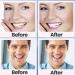Vueix Teeth Whitening Strips 5D - 14 Sets for Smoking/Coffee Stain Removal | Home Tooth Whitening Kit - 28pcs White Strips - Buy Online on GoSupps.com