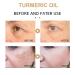 2023 Turmeric Dark Spot Serum Oil - Brighten Skin & Correct Dark Spots (colorless 2P) - Buy Online on GoSupps.com