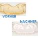 Retainer Cleaning Tablets - 120 Pieces for Fresh & Clean Retainers Braces Dentures | Effective Tab Cleaner for Oral Care - Buy Online on GoSupps.com