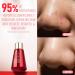 TRUU 5% Mandelic Acid Serum for Oily Skin | Targets Enlarged Pores Exfoliates & Rebalances Oil | Radiant Complexion | 1.1 Oz - International Shipping Available - Buy Online on GoSupps.com