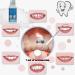 Tooth Provisional Teeth Kit - DIY Heat Fit Beads for Missing & Broken Teeth Replacement | 30ml Bottle | Ideal for Provisional Restoration - Buy Online on GoSupps.com
