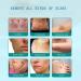 ssq Advanced Scar Spray - Medical Grade Treatment for Acne Scars & Dark Spots - Buy Online on GoSupps.com