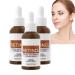Retinol Anti-Wrinkle Facial Serum Concentrate Improves Skin’s Elasticity & Tone and Minimizes Appearance of Fine Lines & Wrinkles – Look Younger With The Age-Defying Power Of Retinol (3pc)