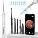 Ear Wax Removal Tool  LMECHN Ear Cleaner with 1920P HD Camera  Earwax Remover with 8 Pcs Ear Set  Otoscope with 6 LED Lights  Ear Wax Removal Kits for iPhone  iPad  Android Phones(White)