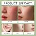 Face Spray 100ml Moisturizing Face Spray Lightweight Breathable Gel Moisturizer for Dry Skin - Women's Beauty Lovers Daily Use Home Travel Makeup - Buy Online on GoSupps.com