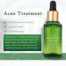 Natural Acne Treatment Essence - Tea Latte Extract | Pore Reducer | 17ml Mild & Non-Fatty Formula - Buy Online on GoSupps.com