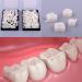 Dental Temporary Tooth Caps 120 Pcs - Front Anterior & Molar Posterior Veneers with Repair Thermal Beads - Ideal for Missing or Broken Teeth - Buy Online on GoSupps.com