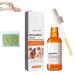 LONGLUAN Fivfivgo Advanced Skin Brightening Serum Melanosis & Dark Spots Remover Advanced Brightening Serum for melanosis and dark spot removal (1pcs)