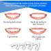 Zyxel Crispy Anti-Snoring Rail - 4-Piece Dental Night Protection for Bruxism & Teeth Grinding | Available in 2 Sizes - Buy Online on GoSupps.com