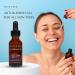 Aesthe Anti-Blemish Gel - Acne Spot Treatment for Oily Sensitive & Combination Skin - Vegan Gluten-Free Facial Skincare - 1.1 fl oz - Buy Online on GoSupps.com
