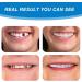 Buy WTTFC Plug-In Veneers - 2 Pairs of Temporary Fake Teeth for Men & Women - Smile Prostheses for a Perfect Look - Buy Online on GoSupps.com