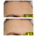 Hoosh Face Wrinkle Pads | 6 Pack Reusable Silicone Patches for Men & Women - Face Lift Mask for Neck, Forehead, Eyes, and Smile Lines Treatment - Buy Online on GoSupps.com