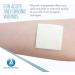 Dynarex DynaGinate Calcium Alginate Wound Dressing - Sterile Non-Stick Gel Pads for Cuts - 10 Count 2x2 Inch - Medical Grade for Moderate to High Exuding Wounds - Buy Online on GoSupps.com