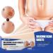 4Pcs Scar Sticker Set | Reduce Infection & Lighten Pigmentation | Acne Scar Removal | Skin Repair Sheet | Style A Color S - Buy Online on GoSupps.com