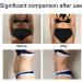 Abdomen Lift Tapes for Firming and Slimming | Cellulite and Sagging Skin Treatment | Tummy Slimming Wrap for Definition - Buy Online on GoSupps.com