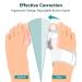 Bunion Corrector for Women Men - Adjustable Splint for Bunion Relief with Toe Separators - Orthopedic Toe Straightener Set - 2 Pairs Silicone Straighteners - 3 Pairs Spacer Included - Buy Online on GoSupps.com