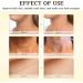 Neck Firming Cream Bee-Venom Neck Cream Stick Skin Tightening Cream Body Anti Wrinkle Cream Anti Aging Moisturising & Nourishing Lifting Smooth Neck Lines Night Cream For Women - Buy Online on GoSupps.com