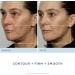 Nuface Trinity Starter Kit - Ultimate Facial Toning Device for Radiant Skin | Fast International Shipping - Buy Online on GoSupps.com
