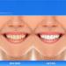 Xoermioy Niacinamide Whitening Toothpaste - Brightening & Deep Clean Kit (2PCS) for Dazzling White Smile | International Shipping - Buy Online on GoSupps.com